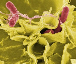 Salmonella spp vista desde microscopio. Fuente: WikiImages